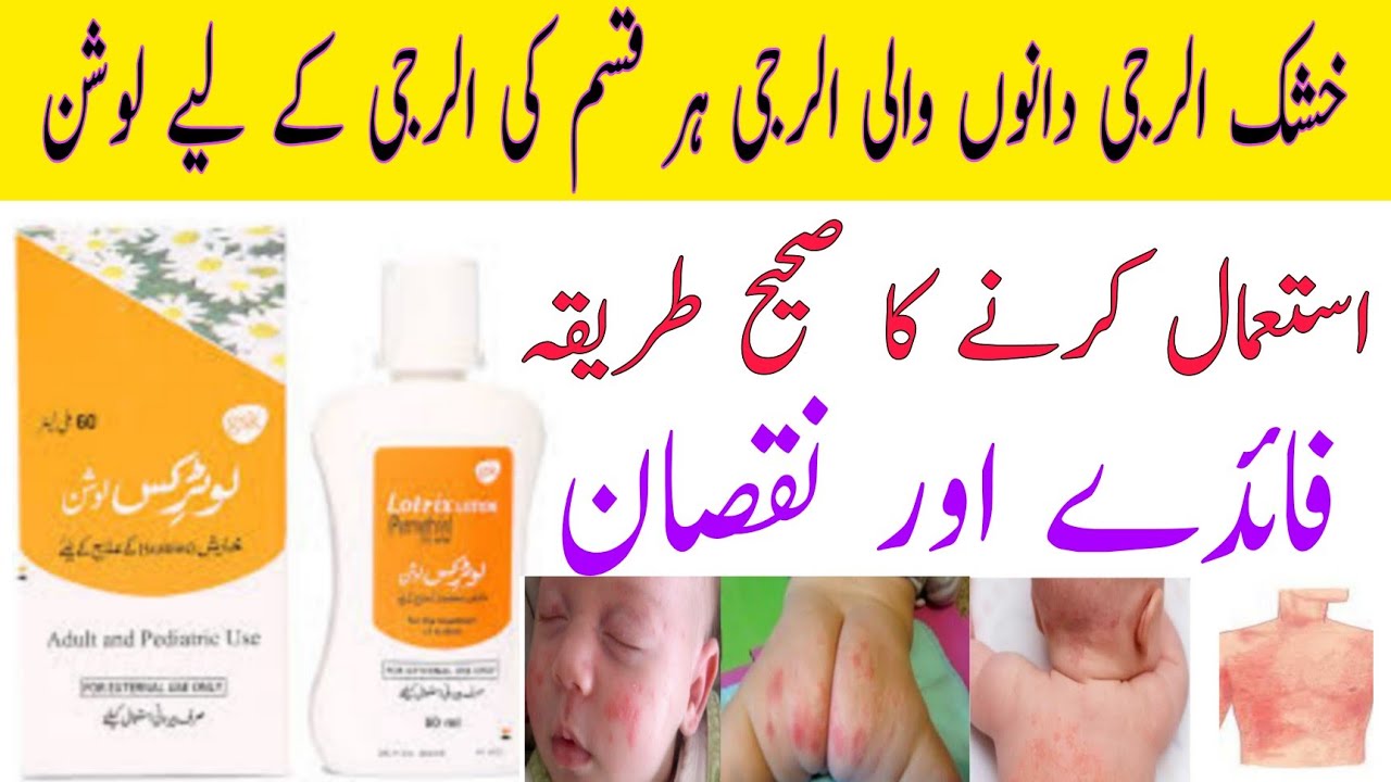 Lotrix (5%) 60ml Lotion Price in Pakistan - Uses, Dosage, and More